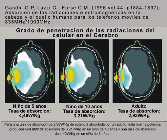 Radiaciones de celulares en el cerebro